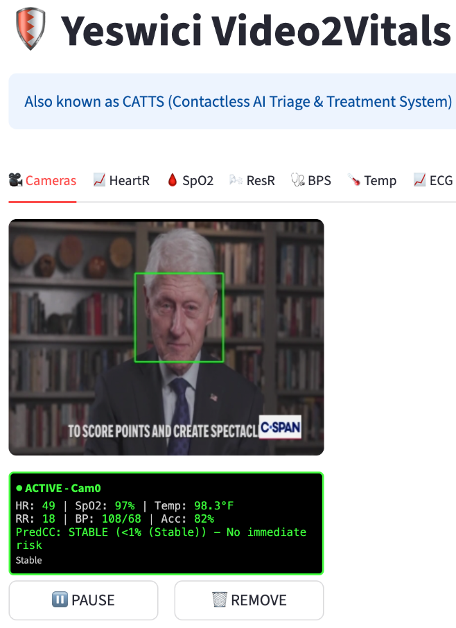Video2Vitals UI Interface